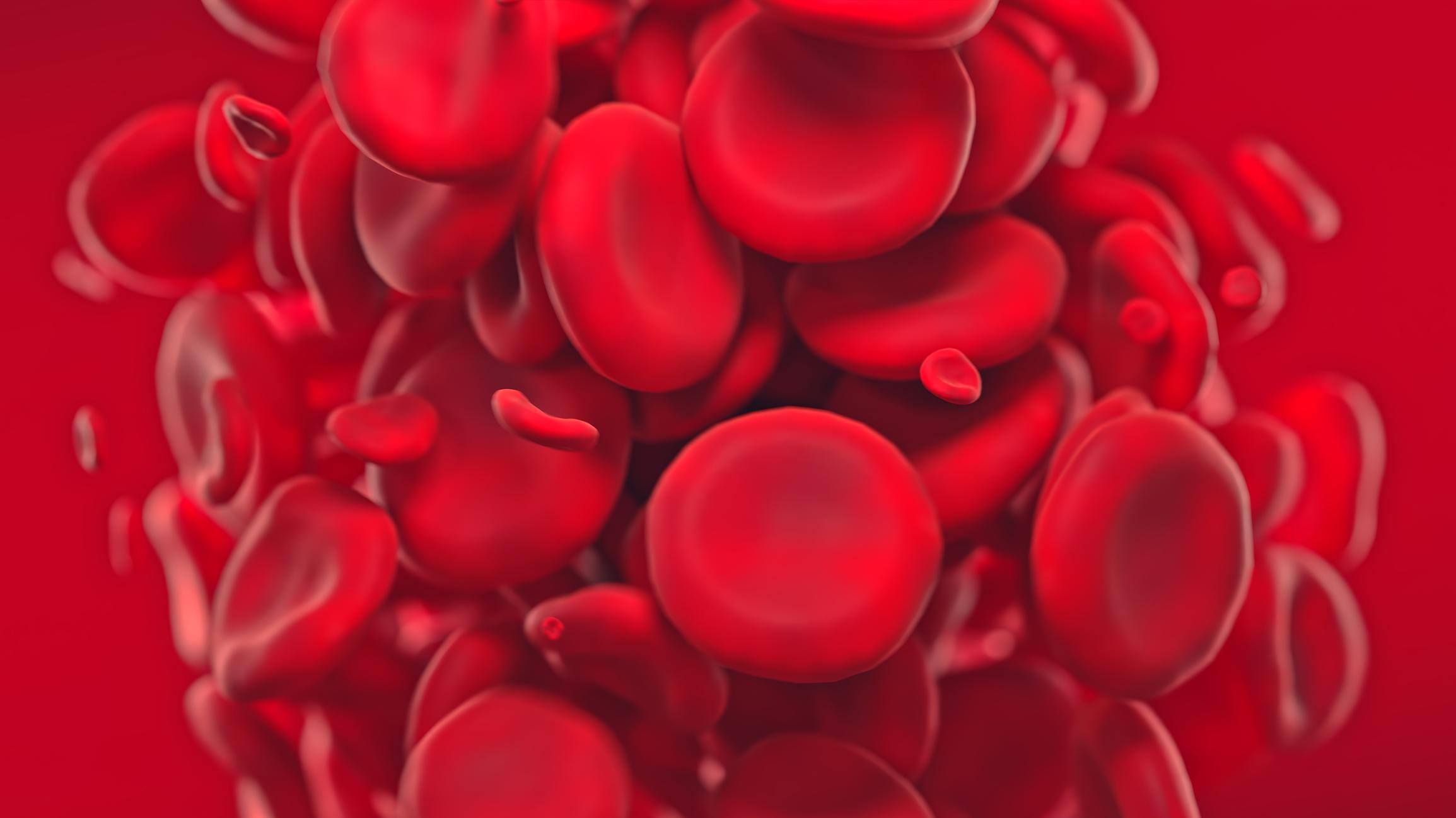 Maladie de Vaquez : symptômes, traitements et espérance de vie. Découvrez le pronostic, les complications et l’évolution de cet excès de globules rouges.