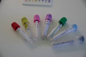 Méningo-encéphalite : symptômes, causes et traitements de cette infection neurologique