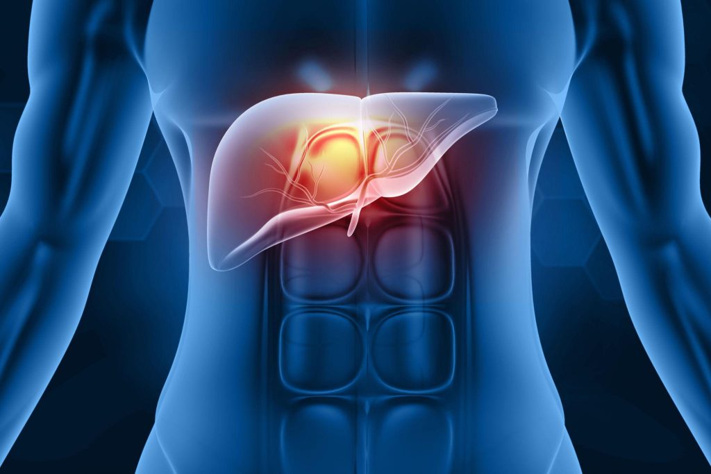 Hépatite médicamenteuse : découvrez les causes, les symptômes, le diagnostic, les traitements et les moyens de prévenir cette atteinte du foie.