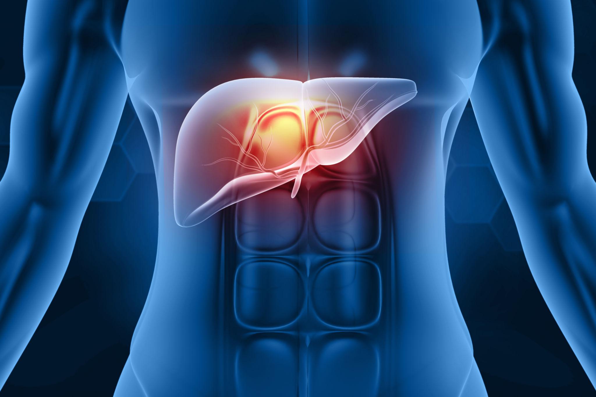 Hépatite médicamenteuse : découvrez les causes, les symptômes, le diagnostic, les traitements et les moyens de prévenir cette atteinte du foie.